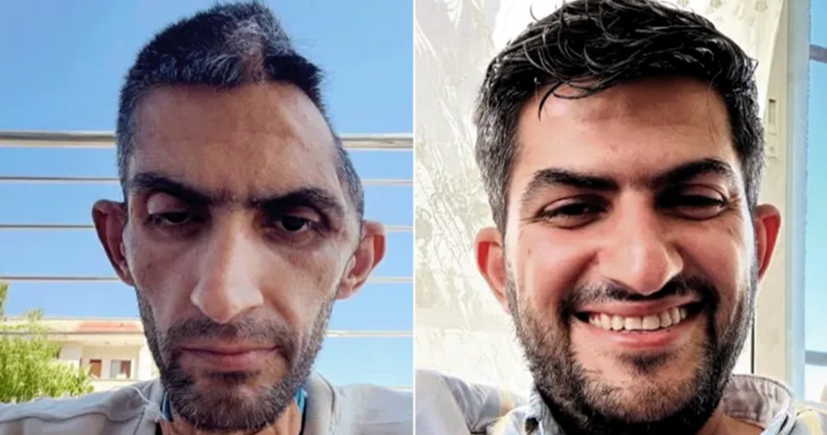 مركز حقوقي : التعذيب في سجون الاحتلال سياسة منظمة وليس تجاوزات فردية 